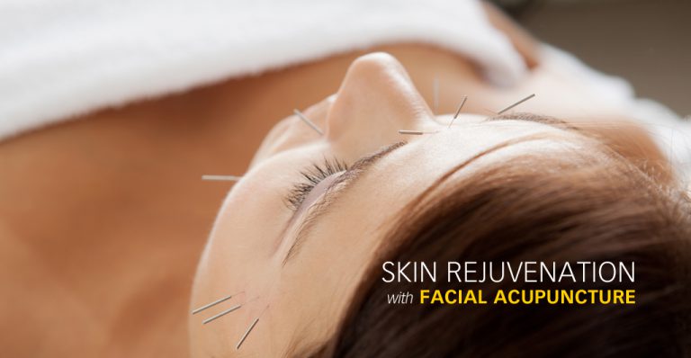 Facial Acupuncture
