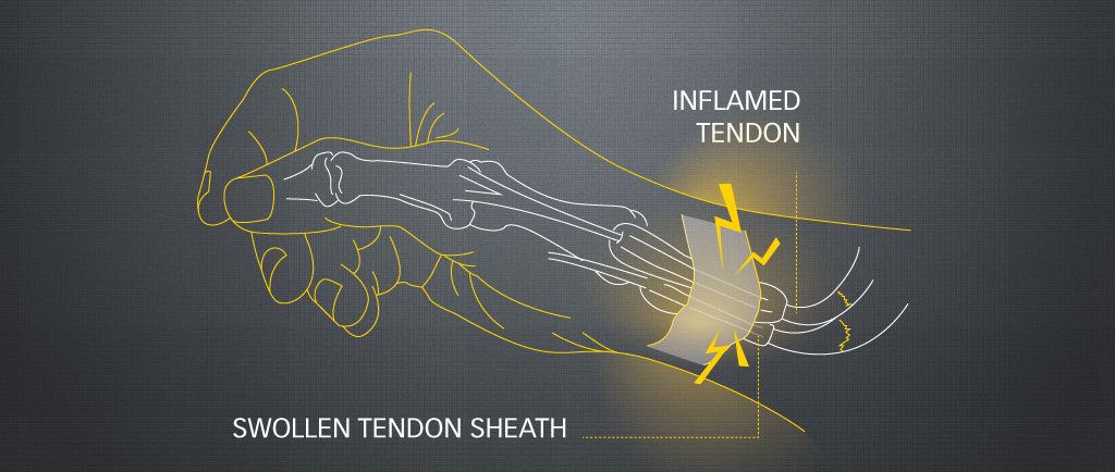 TCM-for-Ma-Ma-shou-3 TCM-for-Ma-Ma-shou-3