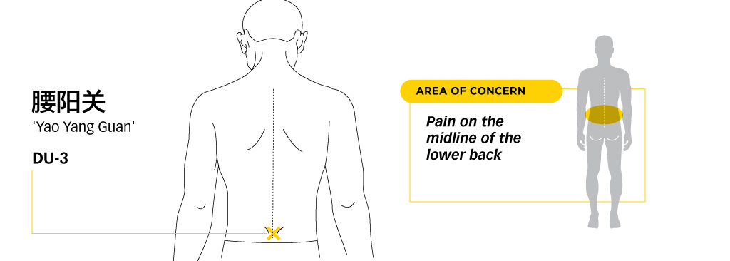 Lower-Back-pain-Management-4-yaoyangguan