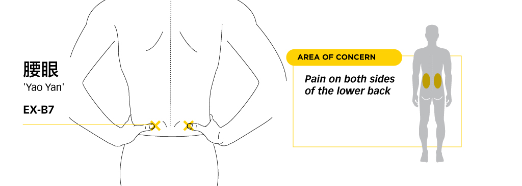 Lower-Back-pain-Management-8-yaoyan