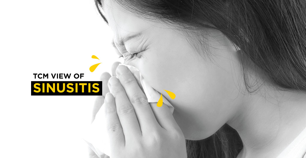 Tcm-alleviate-sinusitis-1