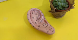 Auricular_Acupressure_1