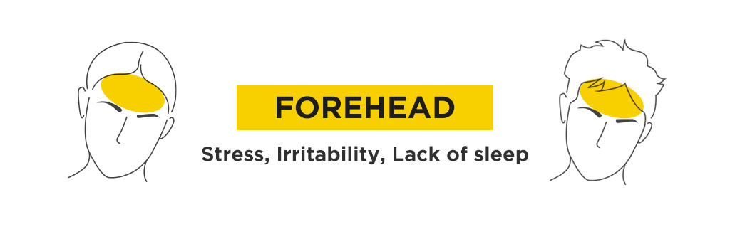 What your acne is telling you based on face mapping 3