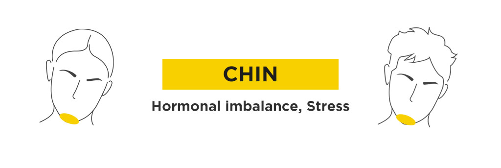 What your acne is telling you based on face mapping 9